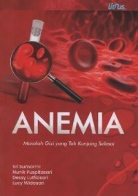 Image of ANEMIA ; masalah gizi yang tak kunjung selesai